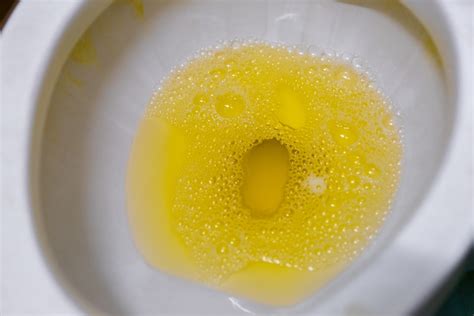 Do B Vitamins Make Your Pee Yellow? And Why Does the Sun Sometimes Smell Like Rain?